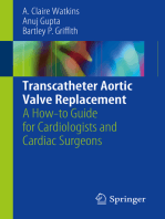 Transcatheter Aortic Valve Replacement