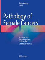 Pathology of Female Cancers: Precursor and Early-Stage Breast, Ovarian and Uterine Carcinomas