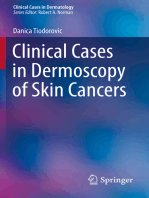 Clinical Cases in Dermoscopy of Skin Cancers