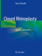 Closed Rhinoplasty: The Next Generation