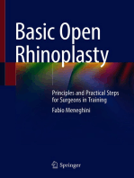 Basic Open Rhinoplasty