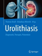 Urolithiasis: Diagnostik, Therapie, Prävention