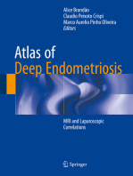 Atlas of Deep Endometriosis: MRI and Laparoscopic Correlations