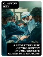 A Short Treatise on the Section of the Prostate Gland in Lithotomy