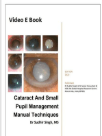 Cataract And Small Pupil Management Manual Techniques: 2022, #1