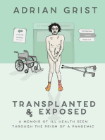 Transplanted & Exposed