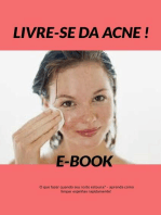 Livre-se da Acne: Como se livrar da acne: dicas de cuidados com a pele de ação rápida!