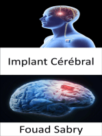 Implant Cérébral