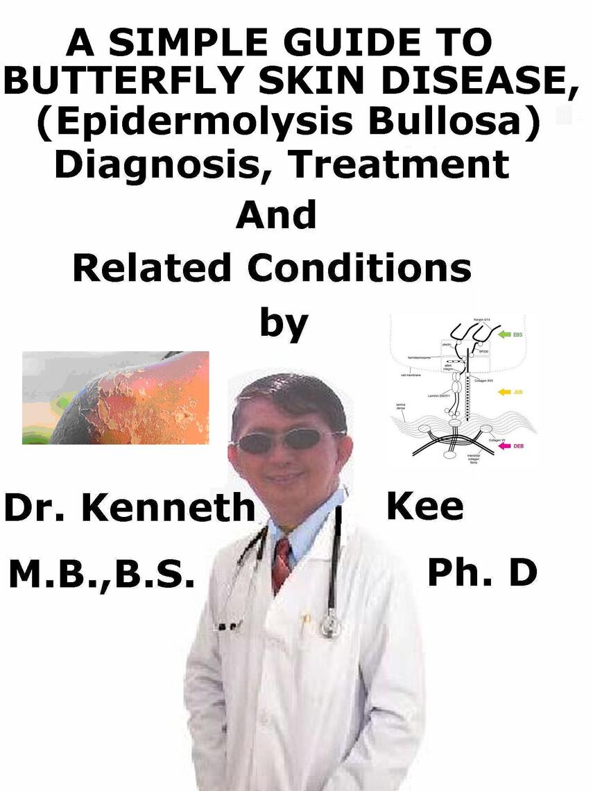 A Simple Guide to Butterfly Skin Disease (Epidermolysis Bullosa