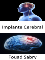 Implante Cerebral