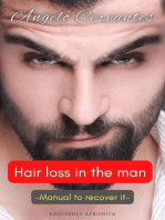 Hair Loss in the Man