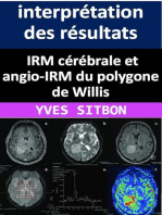 IRM cérébrale et angio-IRM du polygone de Willis : interprétation des résultats et implications cliniques.