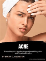 Acne: Everything You Need to Know About Living with and Treating Pimples