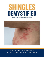 Shingles Demystified: Doctor’s Secret Guide