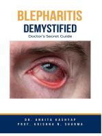 Blepharitis Demystified: Doctor's Secret Guide