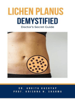 Lichen Planus Demystified Doctors Secret Guide