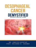 Oesophageal Cancer Demystified Doctors Secret Guide
