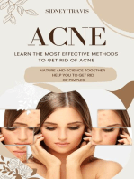 Acne: Learn the Most Effective Methods to Get Rid of Acne (Nature and Science Together Help You to Get Rid of Pimples)