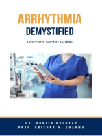 Arrhythmia Demystified: Doctor’s Secret Guide