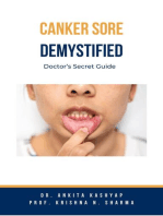 Canker Sore Demystified: Doctor’s Secret Guide