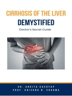 Cirrhosis Of The Liver Demystified: Doctor’s Secret Guide